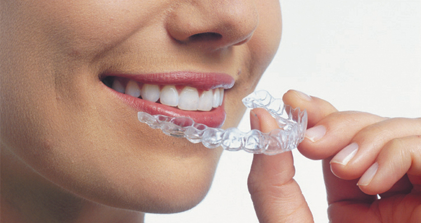 Woman putting in Invisalign