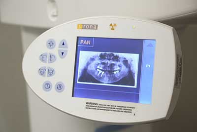 digital dental x ray