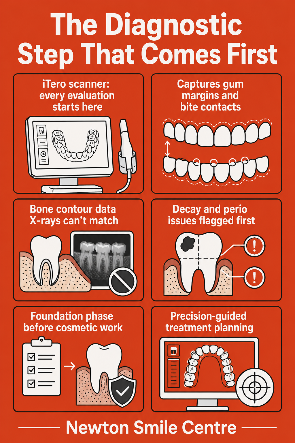 Smile makeover treatment planning sequence infographic showing foundation-first approach